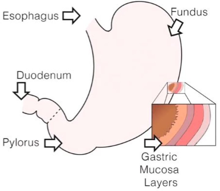 curling’s ulcer