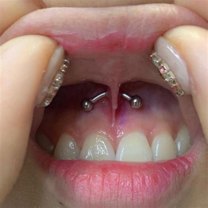 frenulum piercing