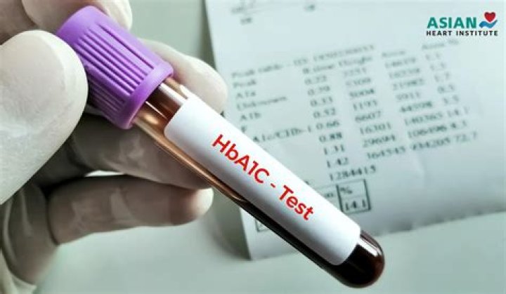 hba1c test cost