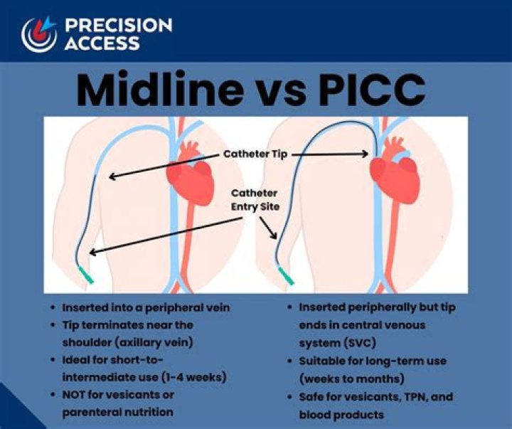 midline vs picc