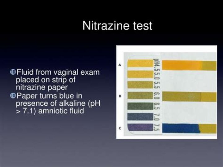 nitrazine test