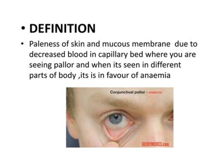 pallor definition