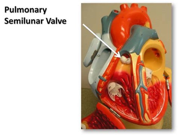 pulmonary semilunar valve