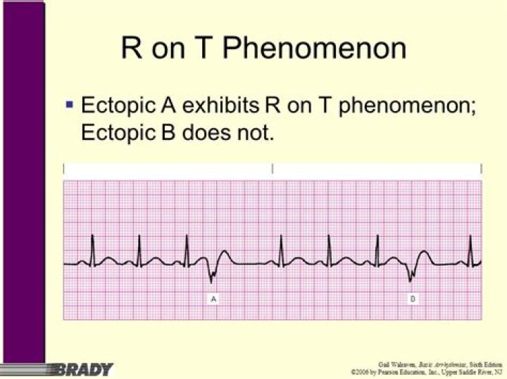 r on t phenomenon